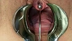 Queen urethral widening and squirting phenomenal sumbission-domination medical deal wound